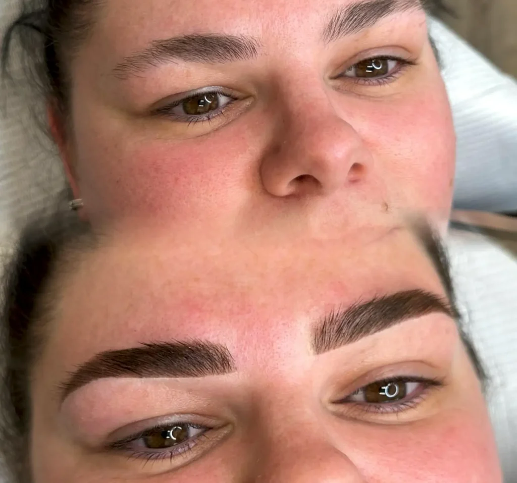 What Skin Layers Do Cosmetic Tattoos Affect
