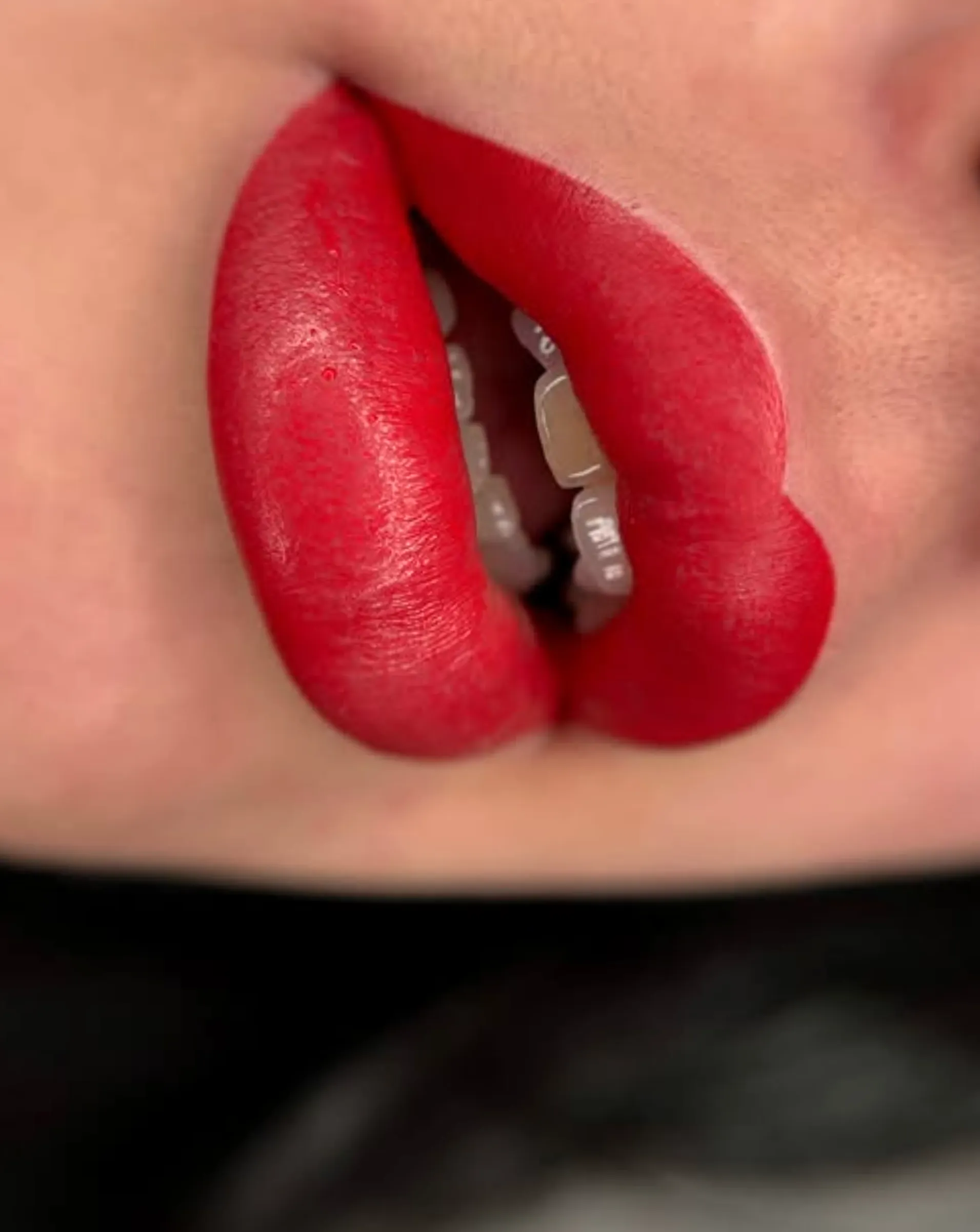 What are the stages of lip tattooing?